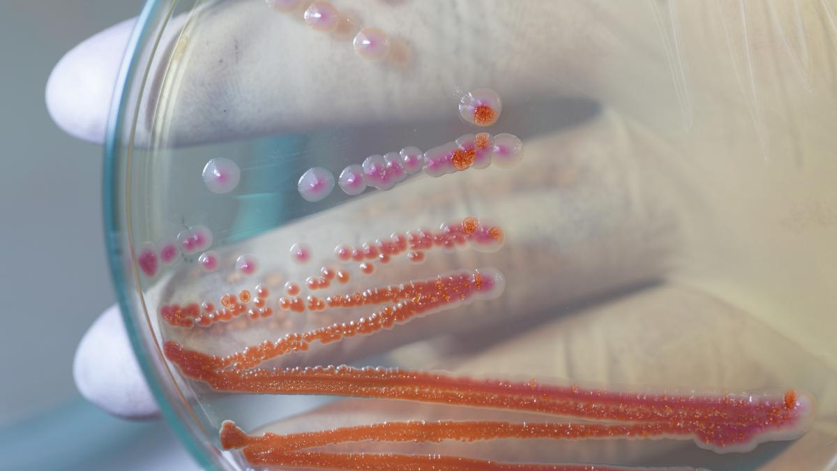 Serratia Marcescens bacteria care a ucis sase copii