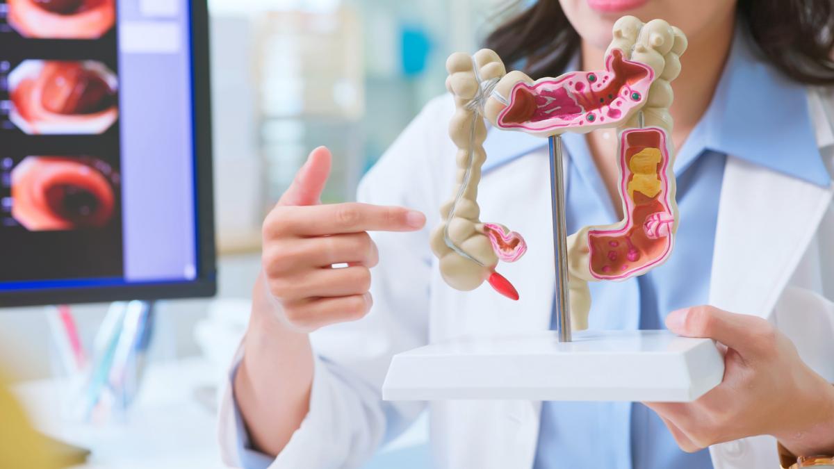 Motivul pentru care un numar tot mai mare de tineri dezvolta cancer colorectal In diverse tari acesta a ajuns sa fie principala cauza de deces